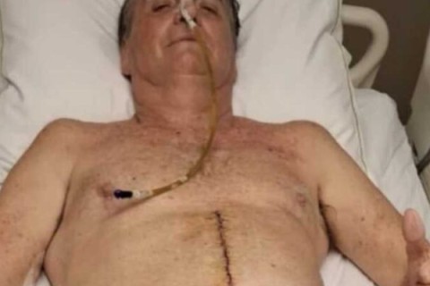 Bolsonaro segue sem movimentos intestinais há duas semanas e permanece na UTI